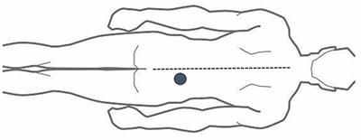 Brain Network to Placebo and Nocebo Responses in Acute Experimental Lower Back Pain: A Multivariate Granger Causality Analysis of fMRI Data